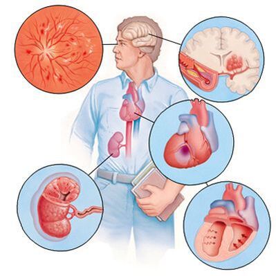 Cardiol prévient le développement de maladies concomitantes